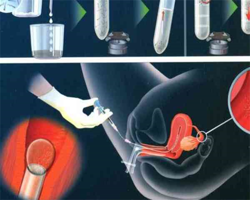 武汉哪家代生好,试管婴儿武汉(武汉试管婴儿价格)