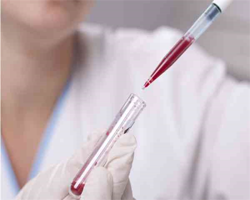 怀孕生产前的常见症状及应对方法，了解生产前必须知道的事项