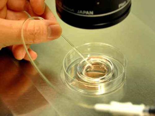 武汉试管婴儿借卵子,武汉试管婴儿什么时候纳入医保？去武汉做试管能用医保