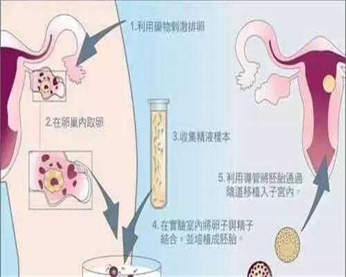 哪里可以供卵试管婴儿&甜子代孕,不孕不育不只是女方问题 男女同查是关键