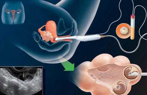 43岁做试管成功的概率&供卵试管选性别,孕期影响宝宝的4种坏习惯