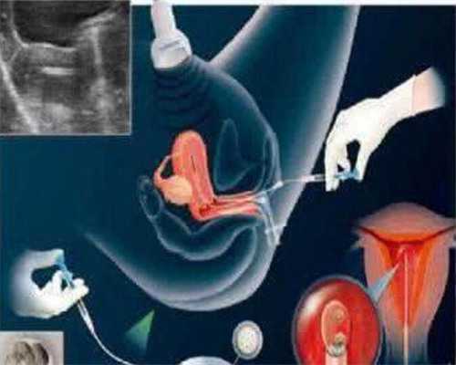 武汉国内代孕公司,武汉同济试管,武汉同济最省钱试管攻略