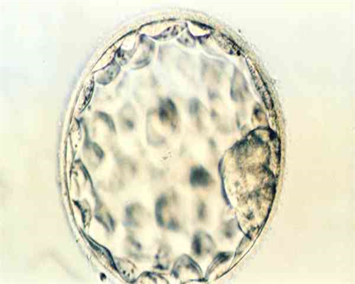 武汉不孕试管婴儿,武汉同济医院做试管,武汉同济做试管多少钱