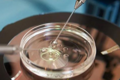 据说穿刺取卵会有后遗症，具体有什么后遗症你知道吗？