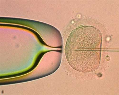 <strong>武汉选性别包生,武汉做三代供卵代孕婴儿生双胞胎价格是多少？费用10万够吗？</strong>