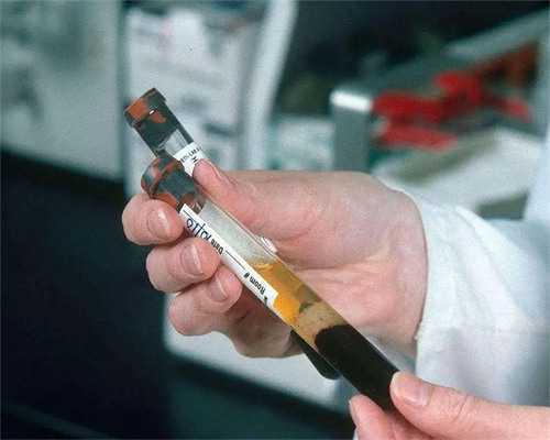 武汉专业代孕网,武汉供卵春晖,武汉供卵试管