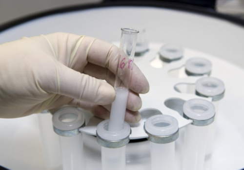 前列腺增生术后后遗症有哪些 前列腺增生的症状有哪些？