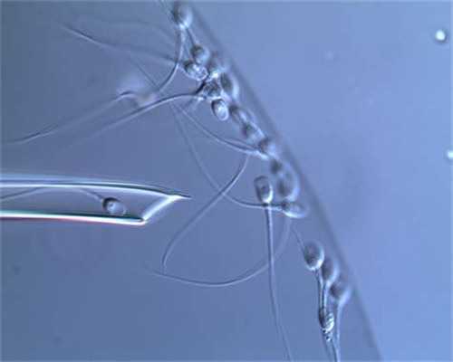 武汉供卵包出生,武汉协和做试管费用(武汉协和2026试管费用)