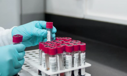 ????日记｜养囊结果：7个养成5个