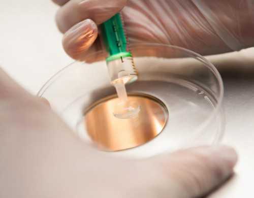 37岁卵巢早衰能调理吗&性别选择生女孩,2026北京协和医院试管婴儿费用一览表，