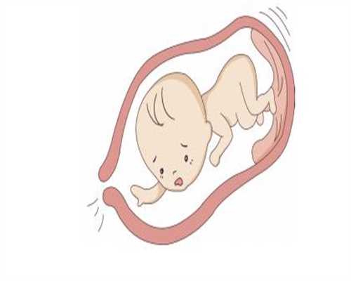 备代孕期间的8大误区 _佑宝代孕育陕西助代孕中