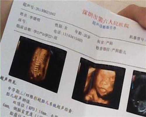 代孕胎儿的这几种异常 B超检查不出来的_那个医