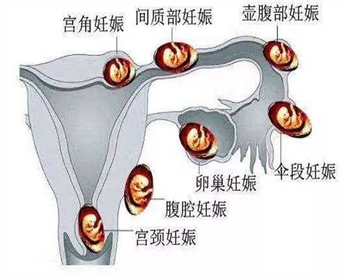 武汉代孕最低多少钱代一个_武汉国内代孕最好的机构_二胎宝宝给谁带？隔代育